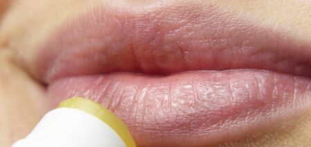 Чтобы не были потресканы и обветрены: как ухаживать за губами