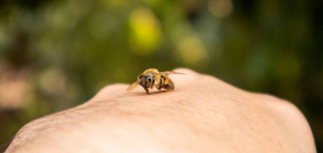 Первая помощь при укусе пчелы: инструкция, которой следует придерживаться для вашей безопасности