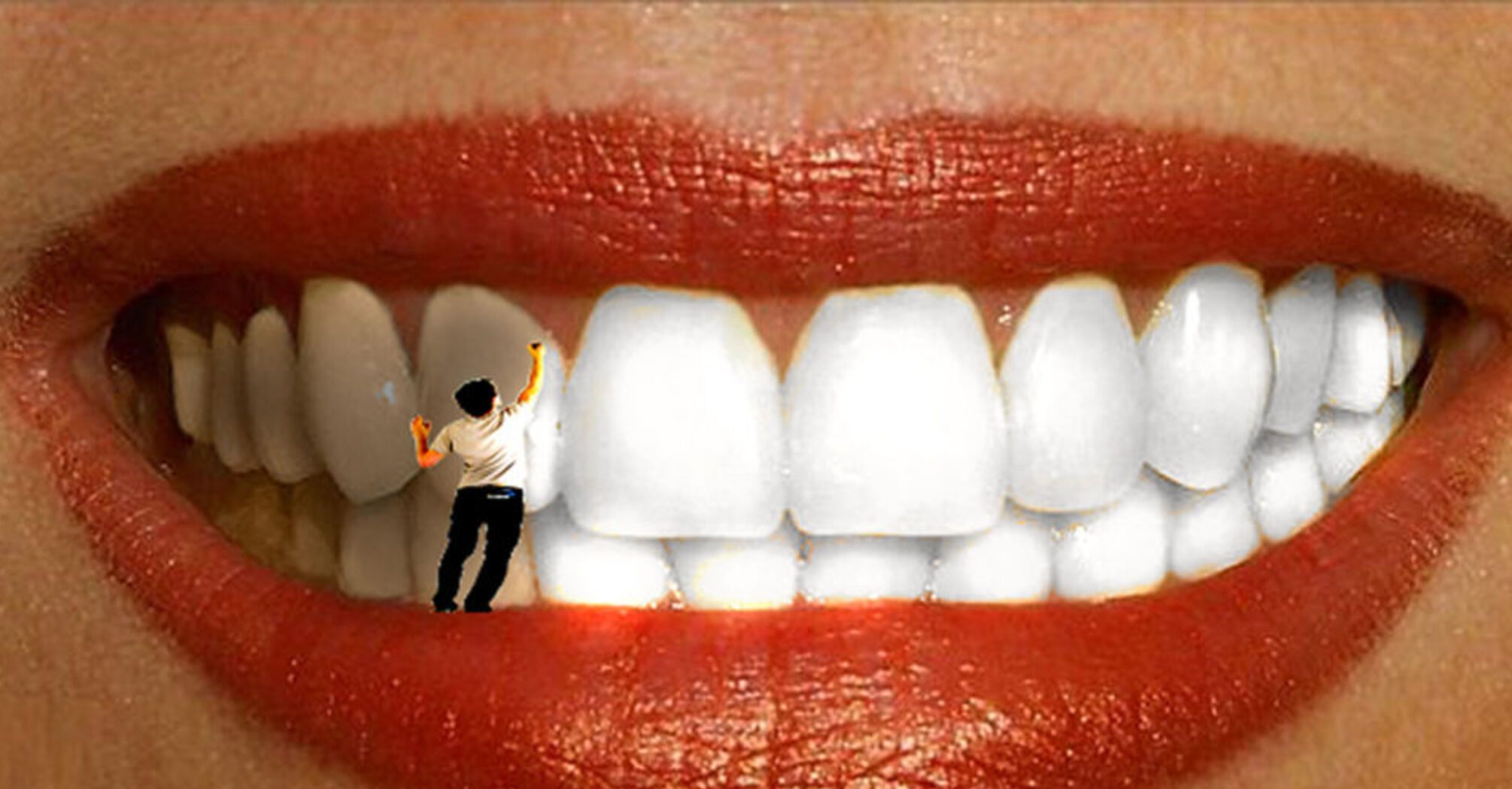 Отбеливание зубов вредно? Мнение стоматолога